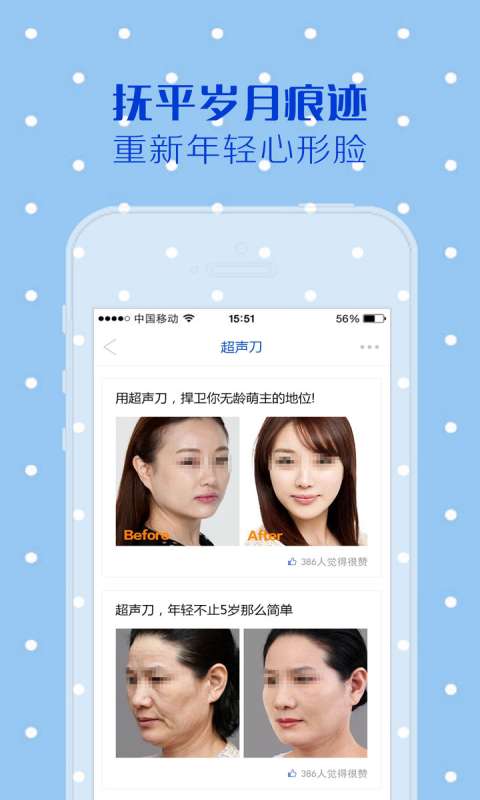 超声刀纯净版下载_超声刀2025最新版下载