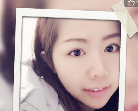201704011031149953001.png